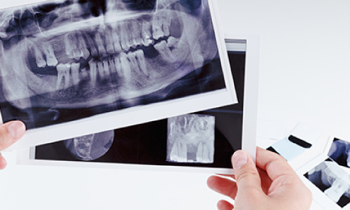 レントゲン写真を眺める歯科医師